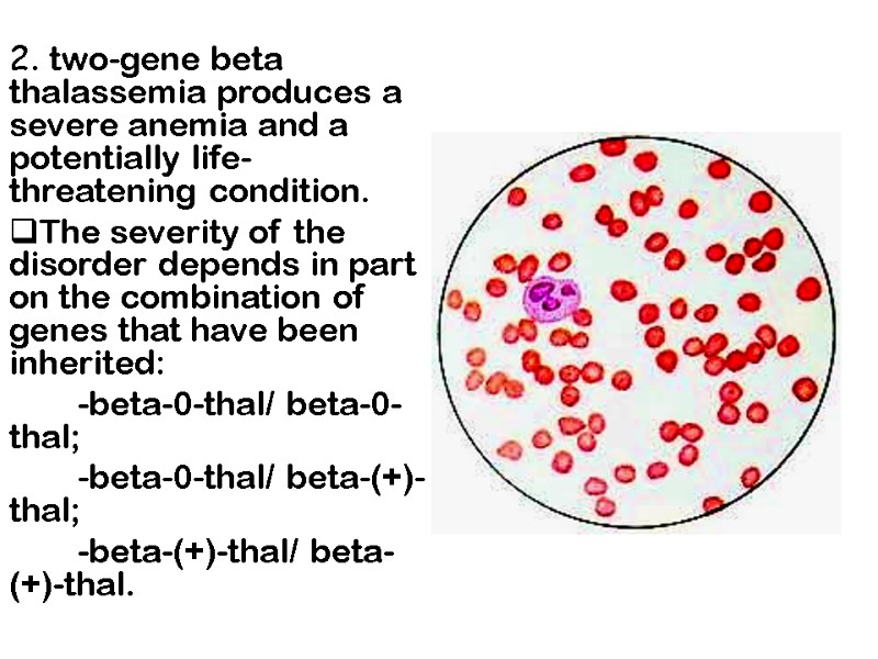 2. two-gene beta thalassemia produces a severe anemia and a potentially life-threatening condition. 